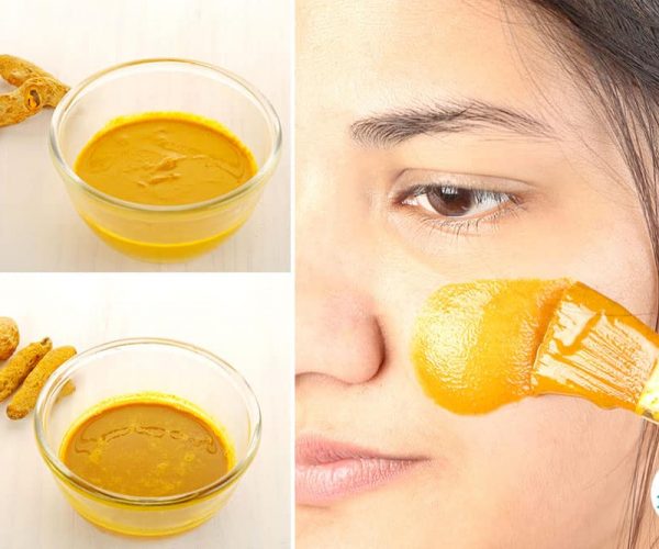 Intro-turmeric-masks-acne-and-pimples